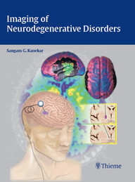 Imaging of Neurodegenerative Disorders 1st Edition PDF