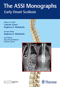 The ASSI Monographs: Early Onset Scoliosis PDF