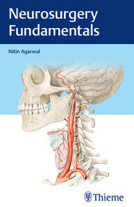 Neurosurgery Fundamentals 1st Edition PDF
