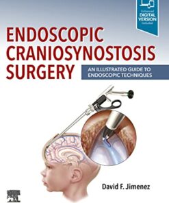 Endoscopic Craniosynostosis Surgery PDF