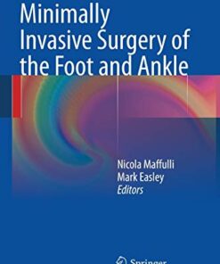 Minimally Invasive Surgery of the Foot and Ankle Softcover reprint of the original 1st ed. 2011 Edition PDF Original