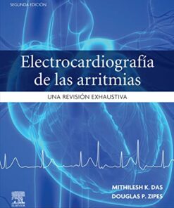 Electrocardiografía de las arritmias: Una revisión exhaustiva, 2nd edition (Original PDF from Publisher)