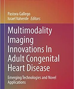 Multimodality Imaging Innovations In Adult Congenital Heart Disease: Emerging Technologies and Novel Applications (Congenital Heart Disease in Adolescents and Adults) (Original PDF from Publisher)