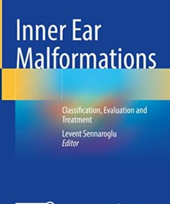 Inner Ear Malformations: Classification, Evaluation and Treatment 1st ed. 2022 Edition PDF Original