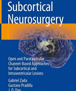 Subcortical Neurosurgery: Open and Parafascicular Channel-Based Approaches for Subcortical and Intraventricular Lesions 1st ed. 2022 Edition PDF Original
