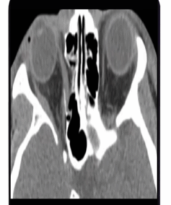 ARRS Imaging Victims of Violence: Fists, Stabs, Bullets, and Blasts 2021 (CME VIDEOS)