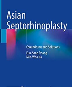 Asian Septorhinoplasty: Conundrums and Solutions 1st ed. 2021 Edition PDF Original