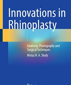 Innovations in Rhinoplasty: Anatomy, Photography and Surgical Techniques 1st ed. 2022 Edition PDF Original