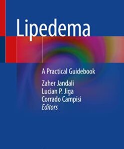 Lipedema: A Practical Guidebook 1st ed. 2022 Edition PDF Original