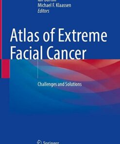 Atlas of Extreme Facial Cancer: Challenges and Solutions 1st ed. 2022 Edition PDF Original