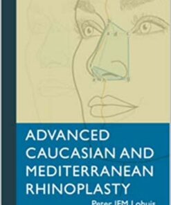 Advanced Caucasian and Mediterranean Rhinoplasty 1st Edition