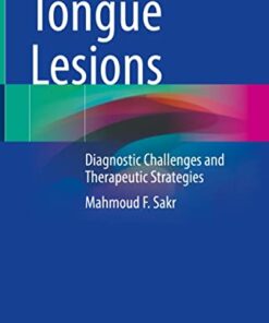 Tongue Lesions: Diagnostic Challenges and Therapeutic Strategies 1st ed. 2022 Edition PDF Original