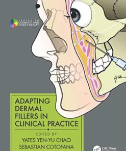 Adapting Dermal Fillers in Clinical Practice (Original PDF from Publisher)