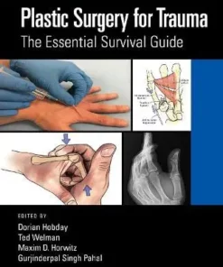 Plastic Surgery for Trauma: The Essential Survival Guide (Original PDF from Publisher)