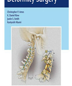 Cervical Spine Deformity Surgery (Original PDF from Publisher)