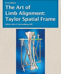 The Art of Limb Alignment: Taylor Spatial Frame (Original PDF from Publisher)