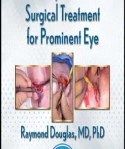 QMP Aesthetic, Customized Surgical Treatment for Prominent Eye 2021 (CME VIDEOS)