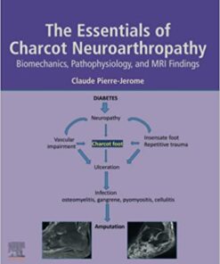 The Essentials of Charcot Neuroarthropathy: Biomechanics, Pathophysiology, and MRI Findings (Original PDF from Publisher)