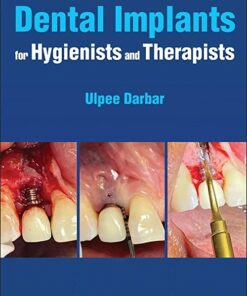 Dental Implants for Hygienists and Therapists 1st Edition PDF Original 