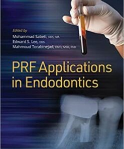 Platelet Rich Fibrin PRF Applications in Endodontics 1st Edition 