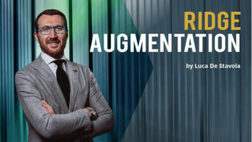 Ridge Augmentation – Luca De Stavola