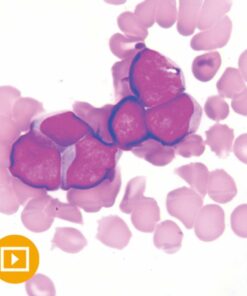 Current Concepts in Hematopathology 2022