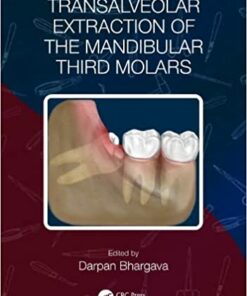 Transalveolar Extraction of the Mandibular Third Molars PDF Original 