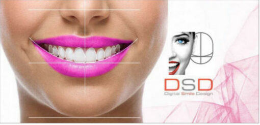Digital Smile Design (DSD) Course