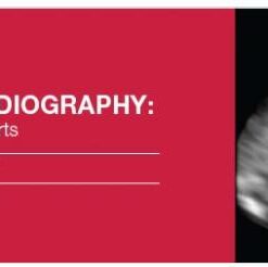 2016 Fetal Echocardiography: Normal and Abnormal Hearts - A Video CME Teaching Activity