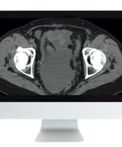 Radiologic Reasoning: A Rapid-Fire Multispecialty Review