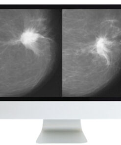 Harmonizing Breast Cancer Screening Recommendations Hybrid Course