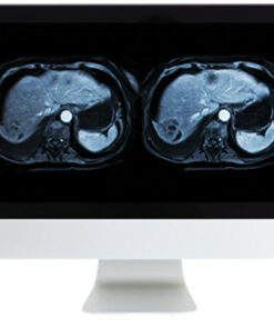 Abdominal and Pelvic MRI