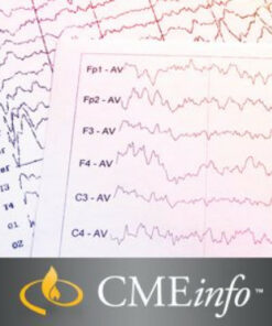 Epilepsy Update & Review Cleveland Clinic Specialty Review