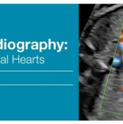 2018 Fetal Echocardiography: Normal and Abnormal Hearts - A Video CME Teaching Activity