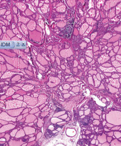 Head and Neck Pathology 2020