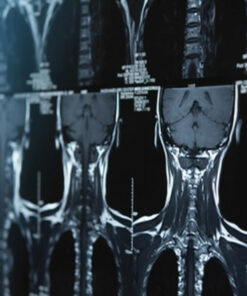 Neurosurgery – A Comprehensive Review 2021