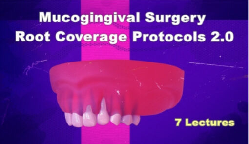 Mucogingival Surgery: Root Coverage Protocols 2.0