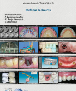 Introduction to Implant Prosthodontics: A Case-Based Clinical Guide Kallipos Open Academic Editions PDF Free download 