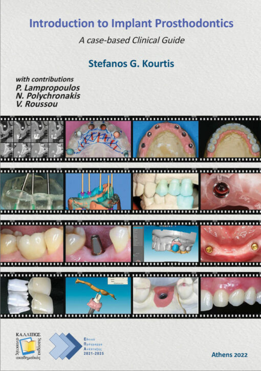 Introduction to Implant Prosthodontics: A Case-Based Clinical Guide Kallipos Open Academic Editions PDF Free download 