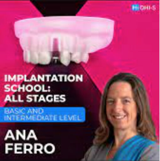 OHI-S Implantation School: All Stages, Basic and Intermediate Level - Ana Ferro - Image 2
