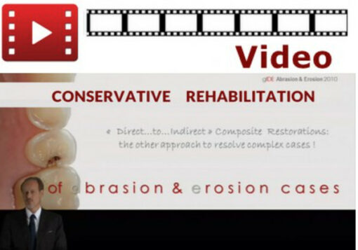 Conservative Rehabilitation of Abrasion & Erosion