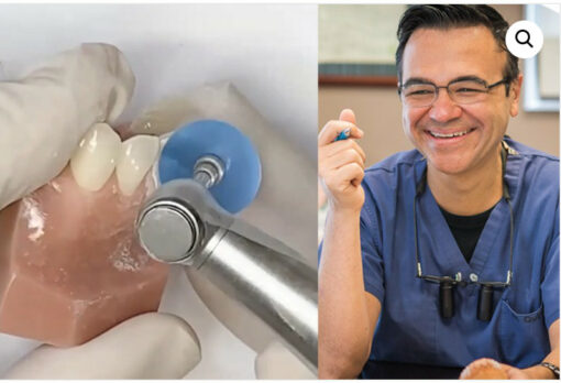 Composite Veneers Training Course: Become a Cosmetic Dentist