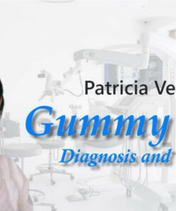 Kidelan Gummy Smile, Diagnosis and Treatment - Patricia Vergara