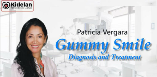 Kidelan Gummy Smile, Diagnosis and Treatment - Patricia Vergara