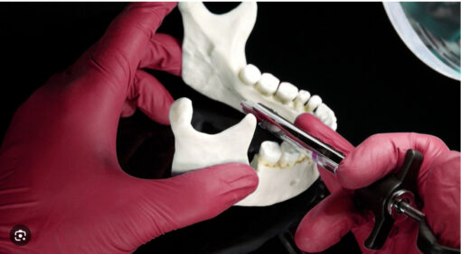 Exodontia Comprehensive Oral Surgery - Jason Hoium Module 1-13 update 2025