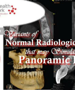 Variants of Normal Radiologic Anatomy that may Simulate Disease on Panoramic Images - Ernest Lam