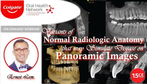 Variants of Normal Radiologic Anatomy that may Simulate Disease on Panoramic Images - Ernest Lam