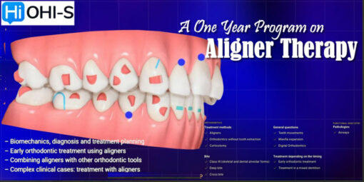 OHI-S A One Year Program on Aligner Therapy