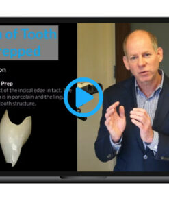 Porcelain Veneer Preparation