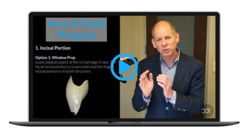 Porcelain Veneer Preparation